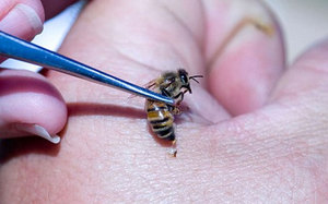 Особенности лечения пчёлами